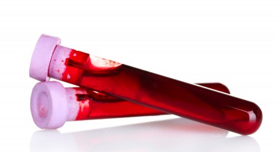 bloodvials bloodvials