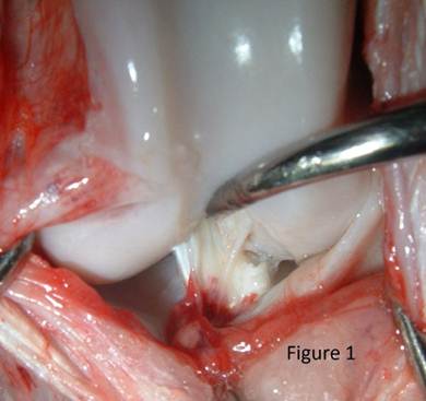 cruciate1 1 cruciate1 1